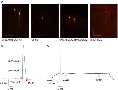 Absence of Pannexin 1 Stabilizes Hippocampal Excitability After Intracerebral Treatment With Aβ (1-42) and Prevents LTP Deficits in Middle-Aged Mice